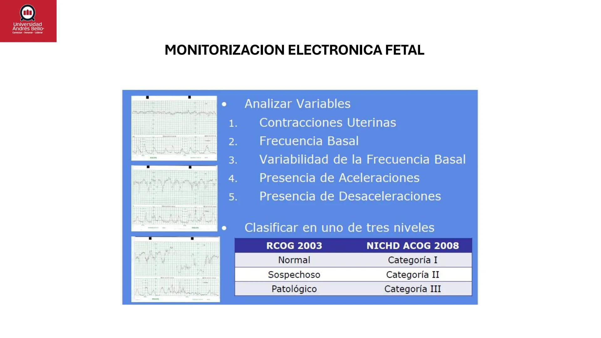 --- OCR Start ---
Universidad
Andrés Bello
Conectar-Innovar-Liderar
CLASE 12
Monitorización Electrónica Fetal
Vigilancia intraparto II: MEFI