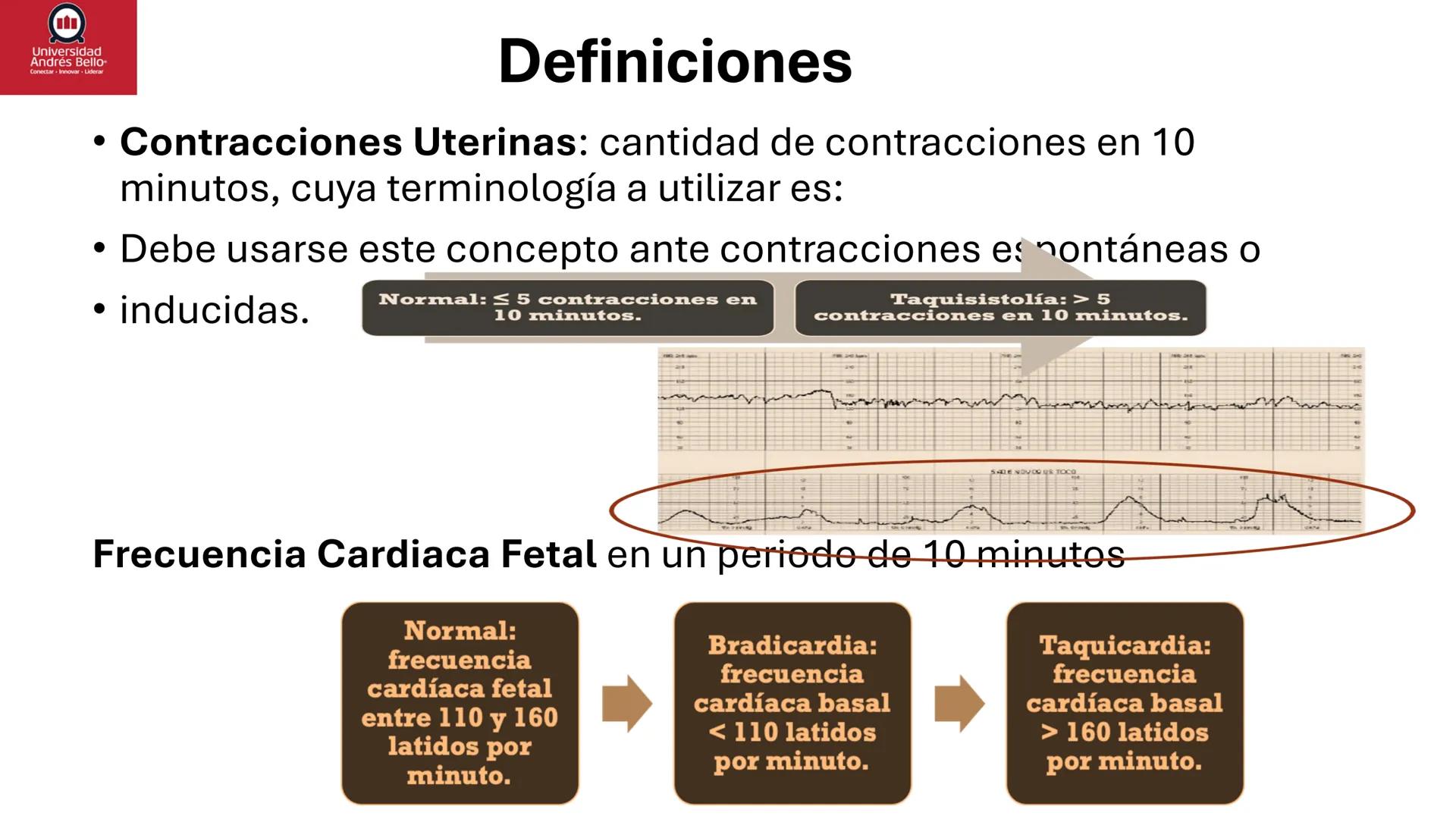 --- OCR Start ---
Universidad
Andrés Bello
Conectar-Innovar-Liderar
CLASE 12
Monitorización Electrónica Fetal
Vigilancia intraparto II: MEFI