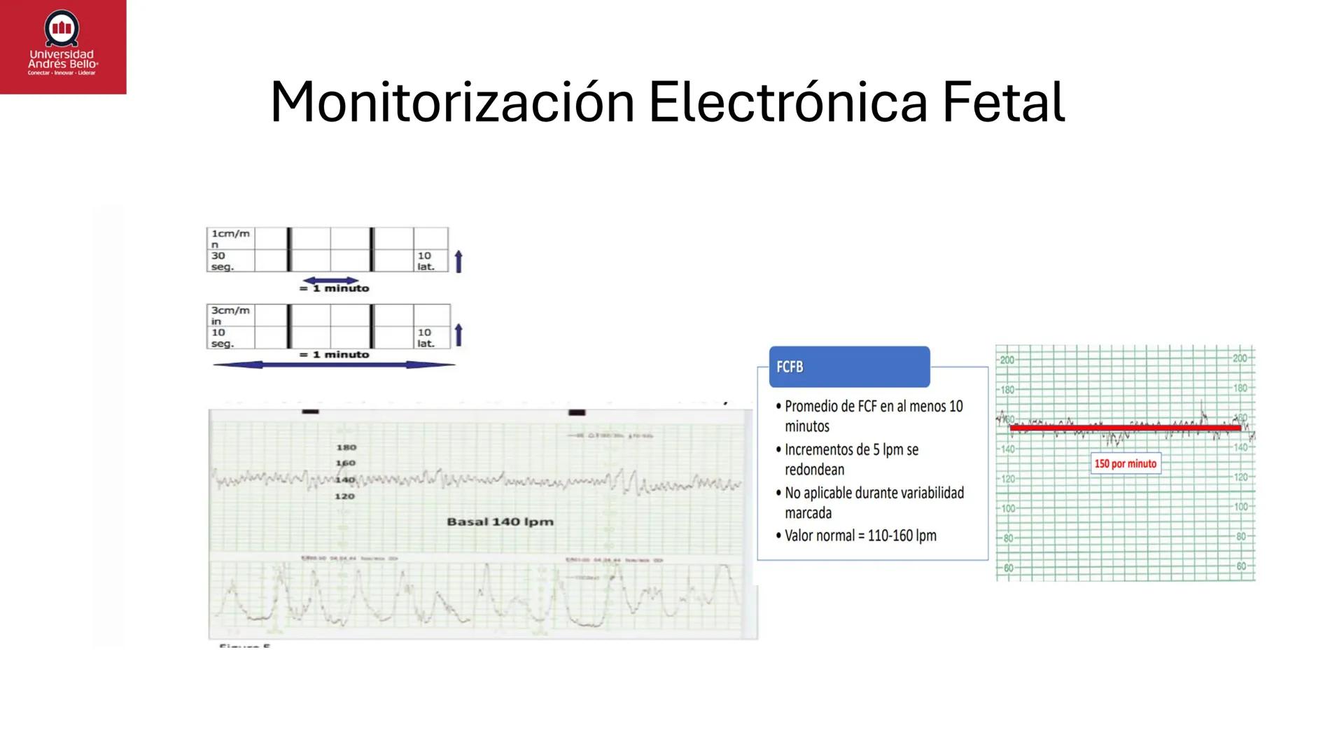--- OCR Start ---
Universidad
Andrés Bello
Conectar-Innovar-Liderar
CLASE 12
Monitorización Electrónica Fetal
Vigilancia intraparto II: MEFI