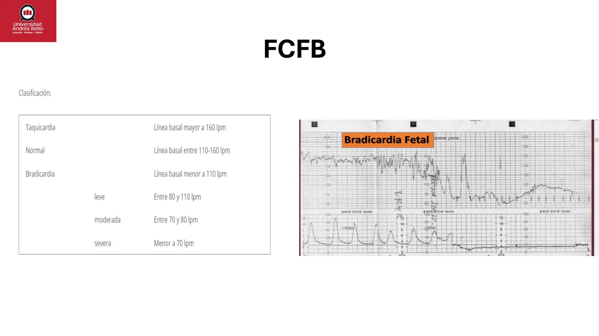 --- OCR Start ---
Universidad
Andrés Bello
Conectar-Innovar-Liderar
CLASE 12
Monitorización Electrónica Fetal
Vigilancia intraparto II: MEFI