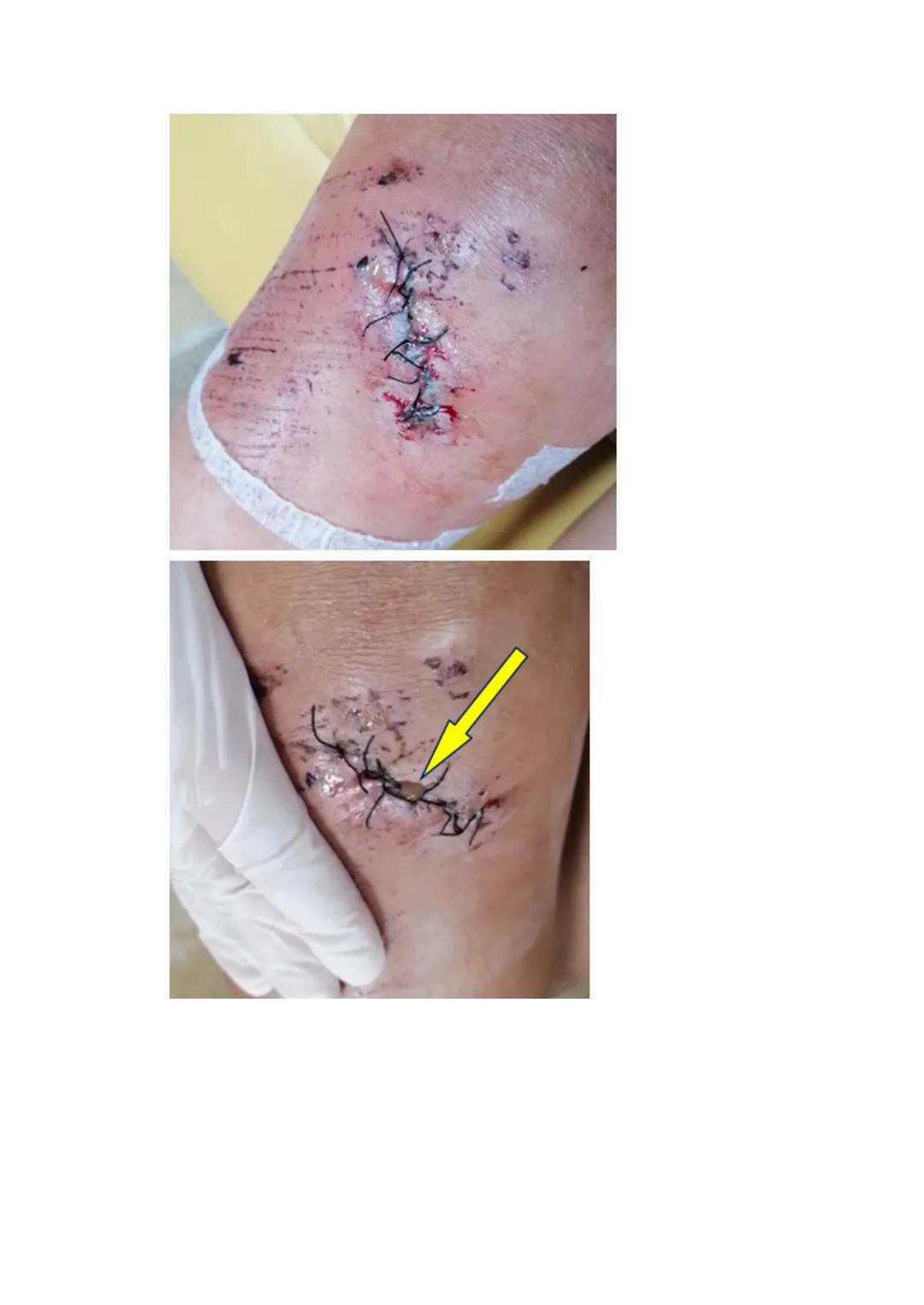 Estímulo
Factor
Agente injuriante
Fisiológica
Normal
Armónica
↑
Respuesta
Célula
Tejido
Órgano
Sistema
Organismo
Fisiopatológica
Anormal
Ina