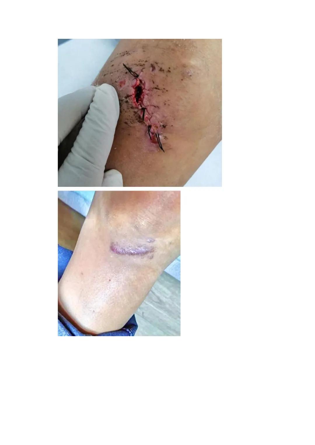 Estímulo
Factor
Agente injuriante
Fisiológica
Normal
Armónica
↑
Respuesta
Célula
Tejido
Órgano
Sistema
Organismo
Fisiopatológica
Anormal
Ina