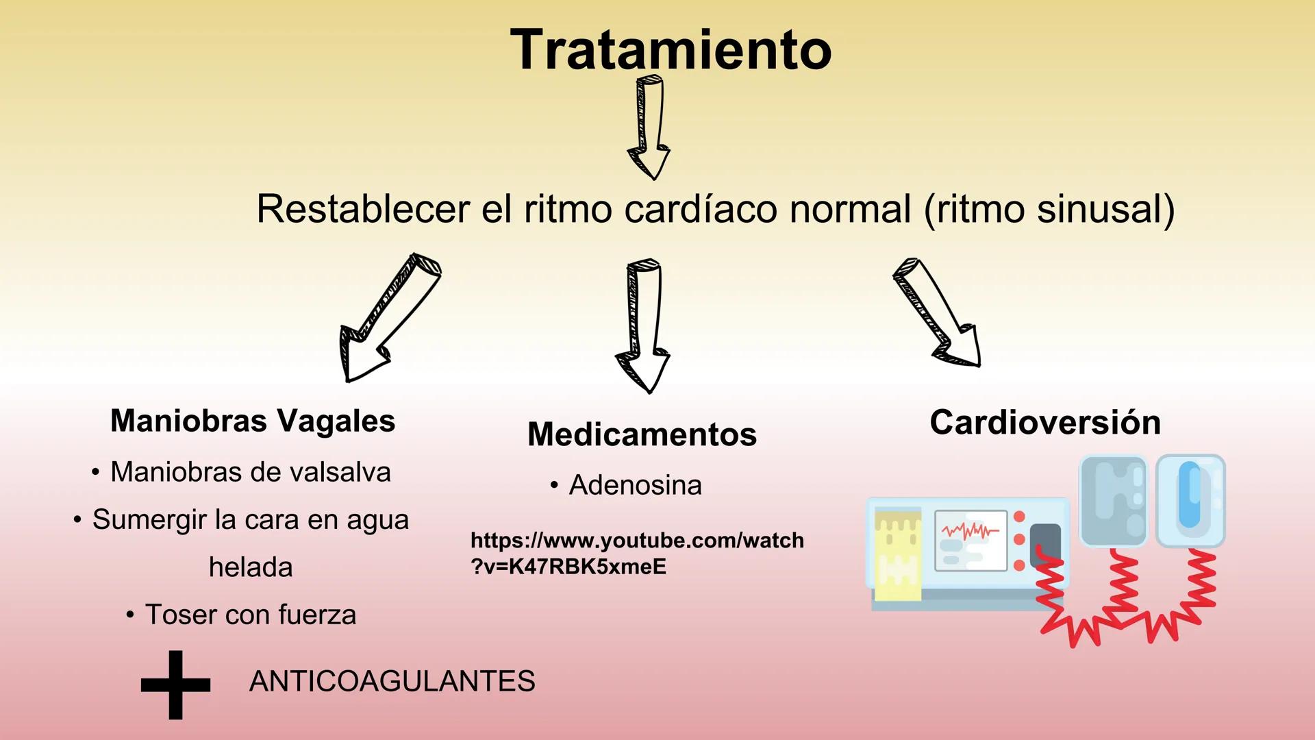 # ARRITMIAS # DEFINICIÓN
- Trastornos del ritmo cardíaco
- Problemas con la frecuencia o el ritmo de los latidos
del corazón.
- Esto sucede
