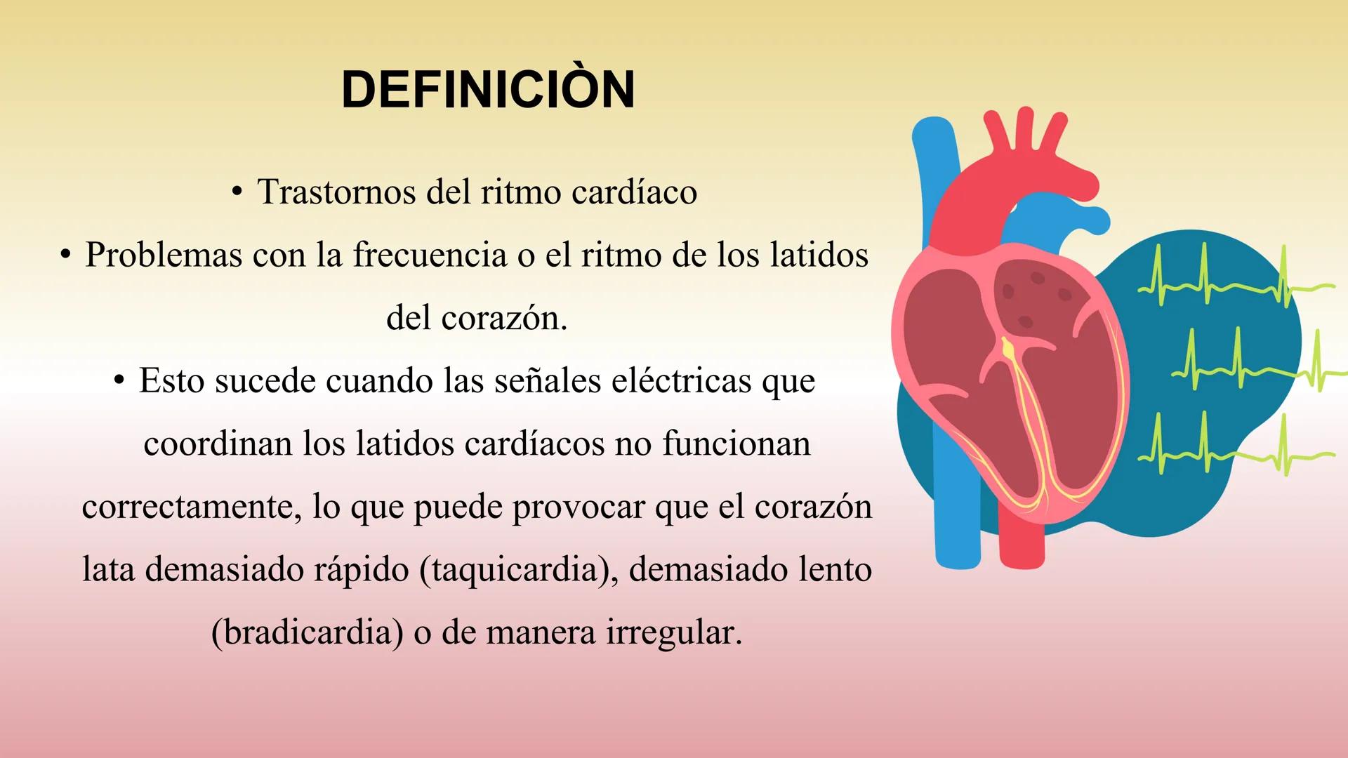 # ARRITMIAS # DEFINICIÓN
- Trastornos del ritmo cardíaco
- Problemas con la frecuencia o el ritmo de los latidos
del corazón.
- Esto sucede