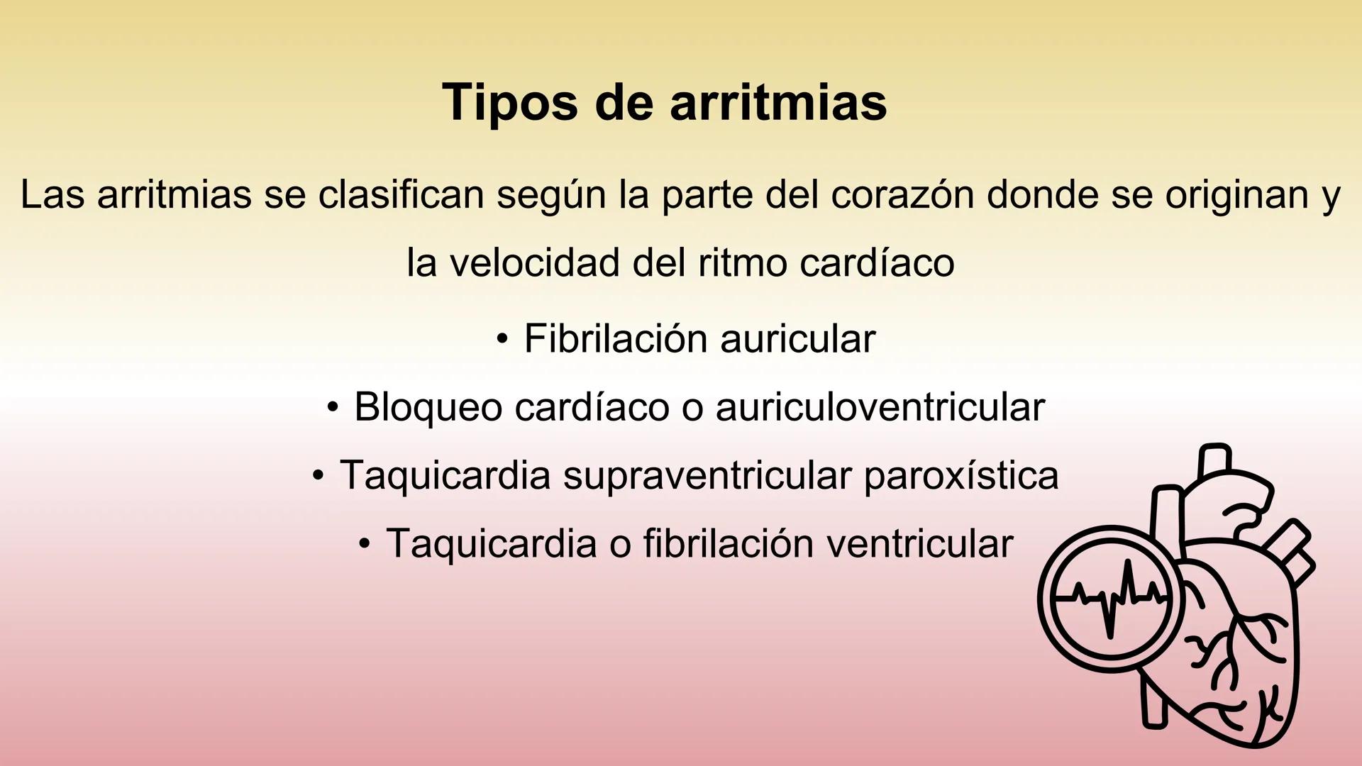 # ARRITMIAS # DEFINICIÓN
- Trastornos del ritmo cardíaco
- Problemas con la frecuencia o el ritmo de los latidos
del corazón.
- Esto sucede
