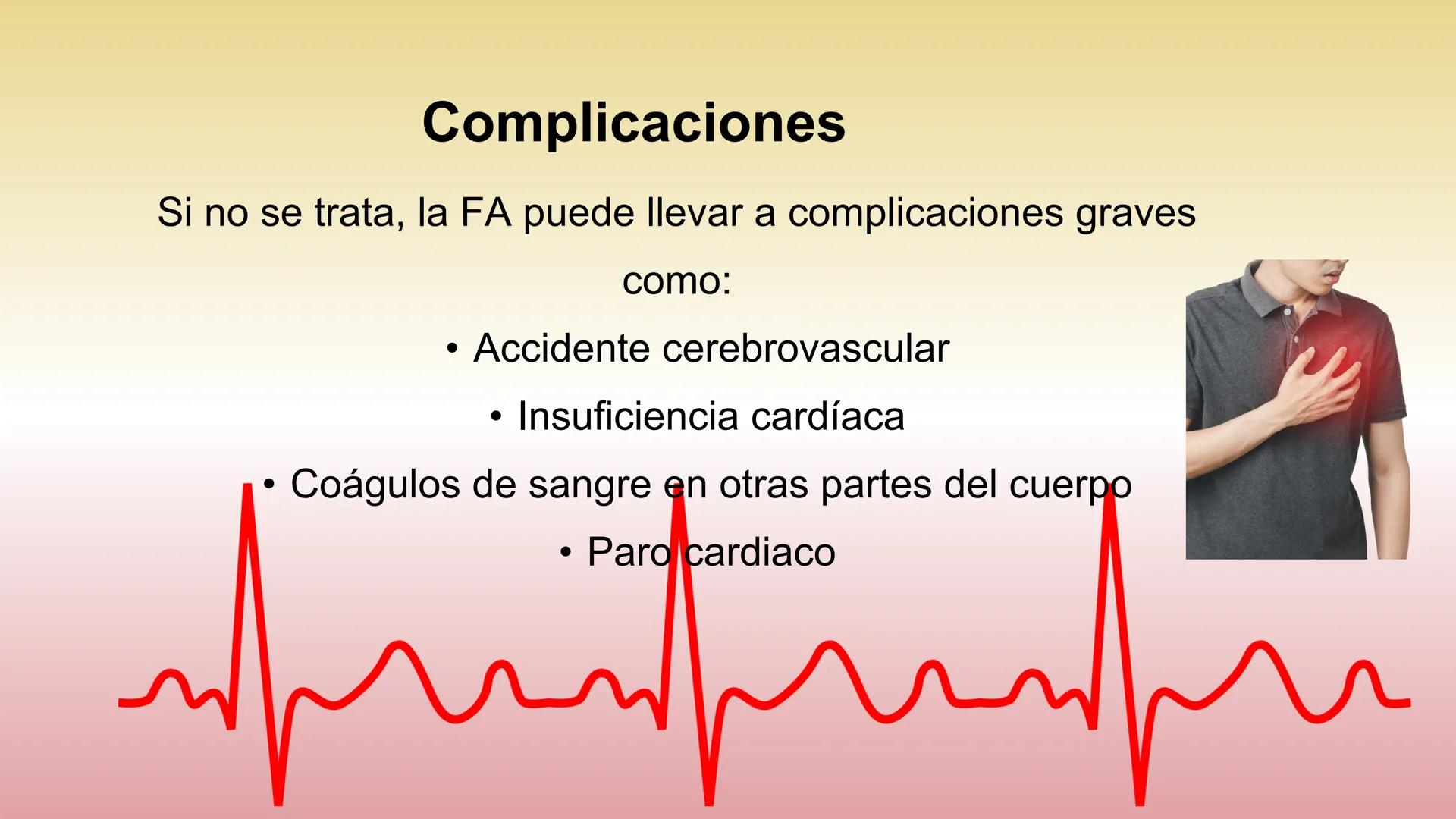 # ARRITMIAS # DEFINICIÓN
- Trastornos del ritmo cardíaco
- Problemas con la frecuencia o el ritmo de los latidos
del corazón.
- Esto sucede