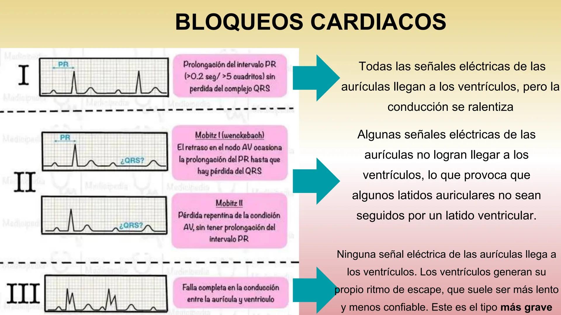 # ARRITMIAS # DEFINICIÓN
- Trastornos del ritmo cardíaco
- Problemas con la frecuencia o el ritmo de los latidos
del corazón.
- Esto sucede