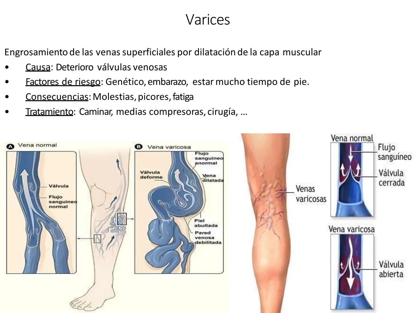 # Anatomía y fisiología del aparato circulatorio
TOC - 085 # GENERALIDADES
* El sistema cardiovascular está formado por el corazón y los va