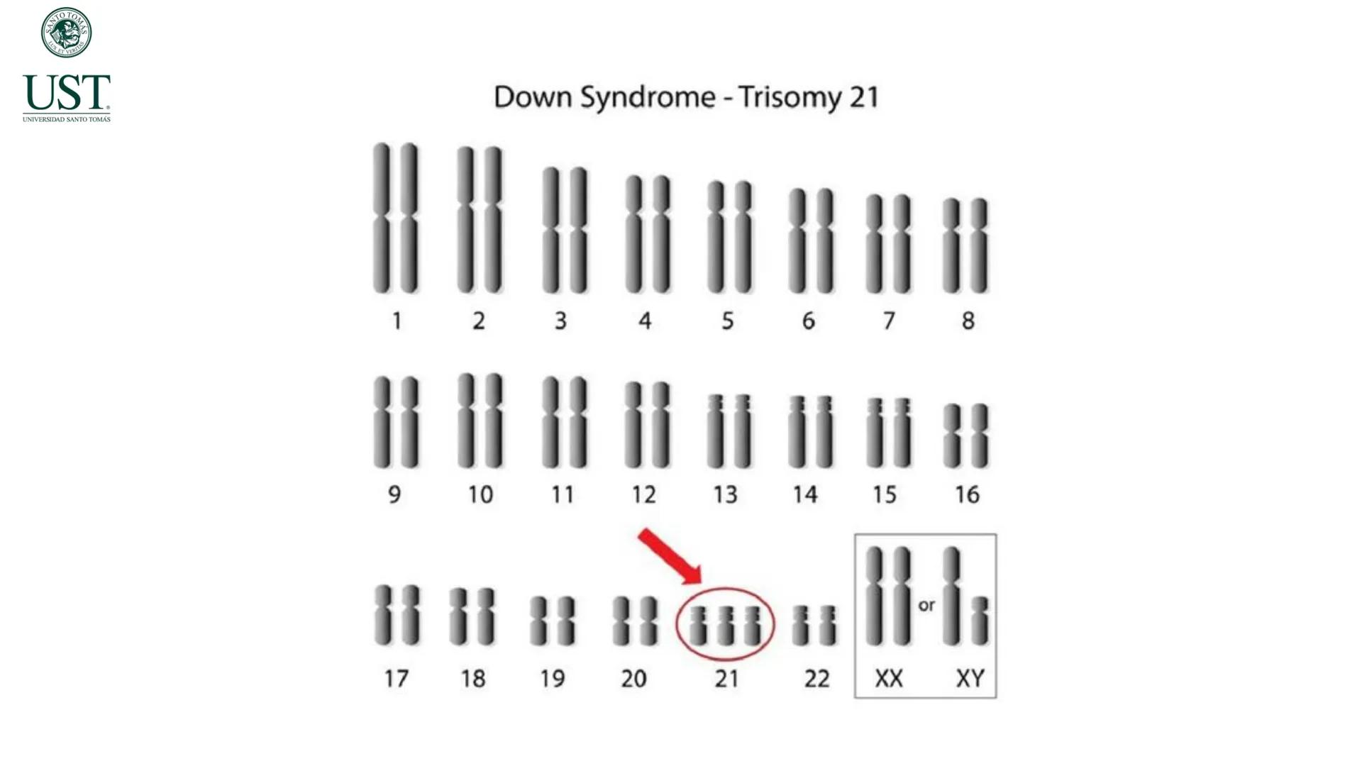 Valoración nutricional en paciente hospitalizado – Síndrome de
Down y Parálisis cerebral
Msc. Nut. Felipe Andrés González Fernández --- OCR