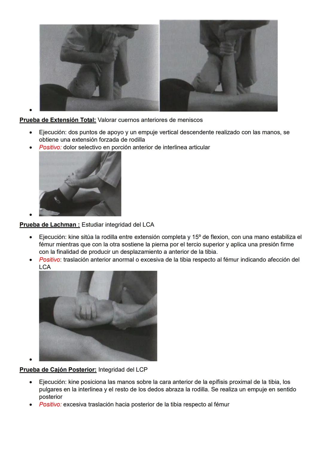 Pruebas especiales
Pelvis y columna
Prueba de Spurling: Afectación de raíces nerviosas cervicales
- Ejecución: ambas manos sobre la cabeza d