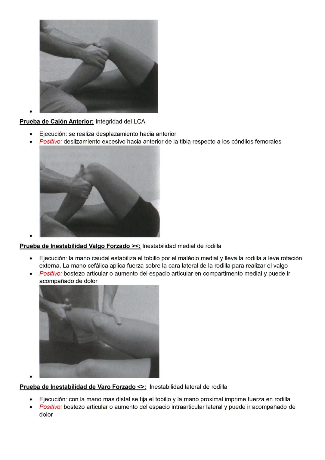 Pruebas especiales
Pelvis y columna
Prueba de Spurling: Afectación de raíces nerviosas cervicales
- Ejecución: ambas manos sobre la cabeza d