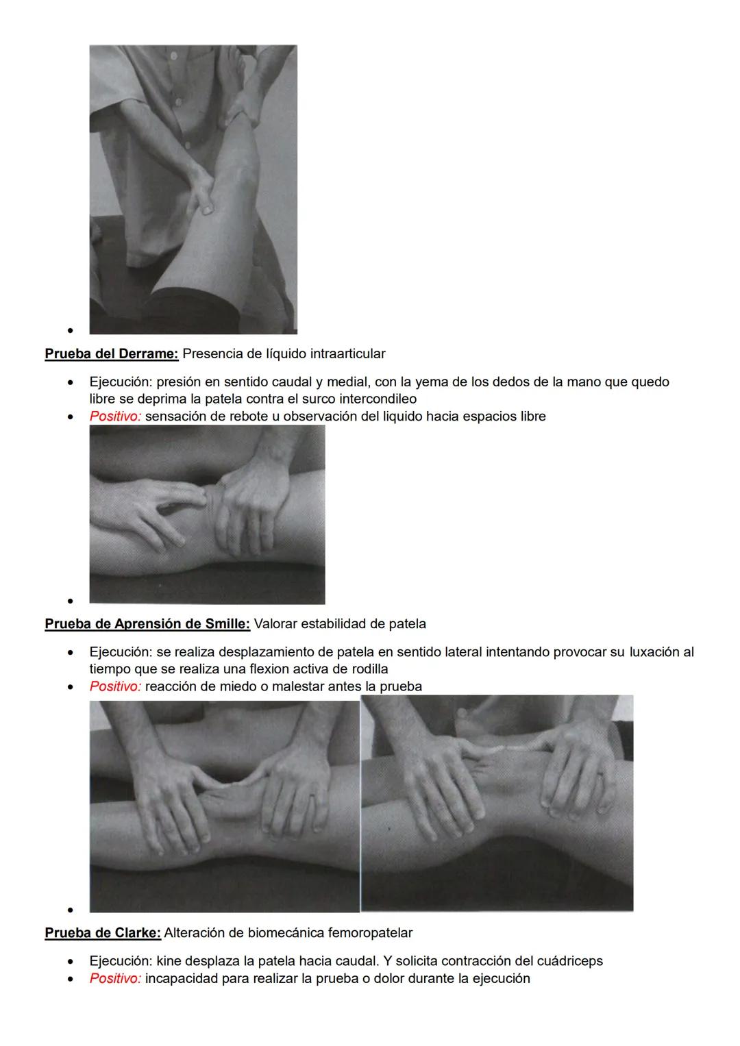 Pruebas especiales
Pelvis y columna
Prueba de Spurling: Afectación de raíces nerviosas cervicales
- Ejecución: ambas manos sobre la cabeza d