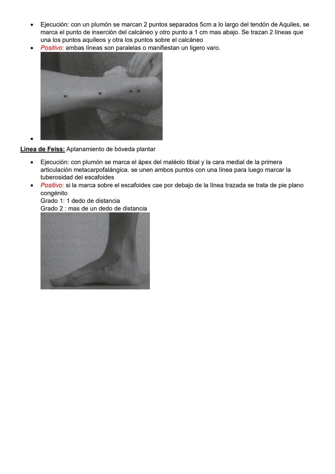 Pruebas especiales
Pelvis y columna
Prueba de Spurling: Afectación de raíces nerviosas cervicales
- Ejecución: ambas manos sobre la cabeza d