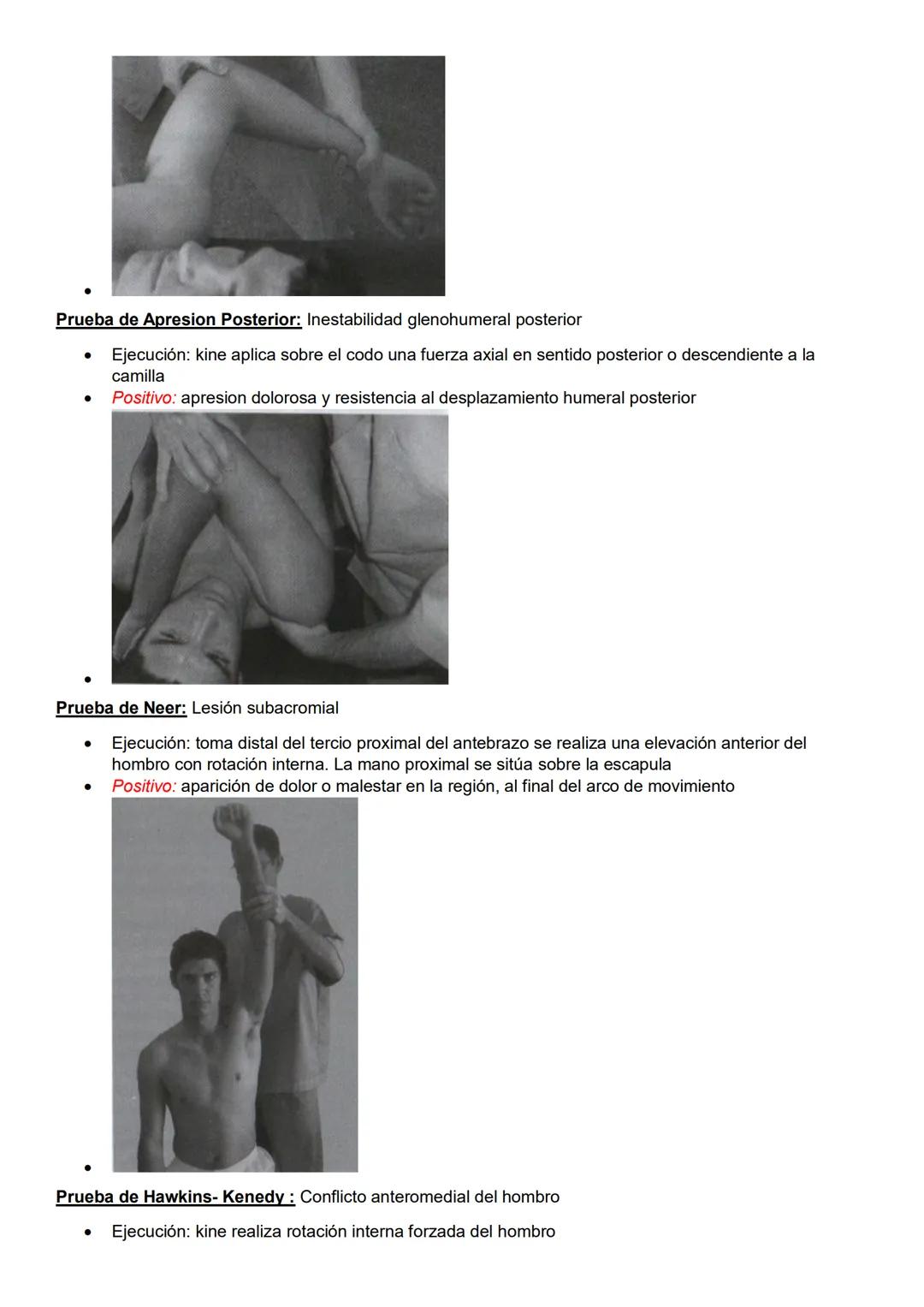 Pruebas especiales
Pelvis y columna
Prueba de Spurling: Afectación de raíces nerviosas cervicales
- Ejecución: ambas manos sobre la cabeza d