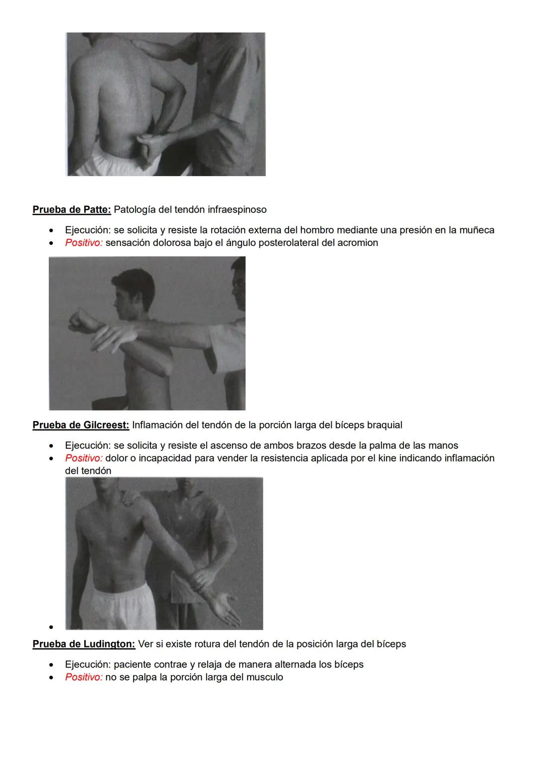 Pruebas especiales
Pelvis y columna
Prueba de Spurling: Afectación de raíces nerviosas cervicales
- Ejecución: ambas manos sobre la cabeza d