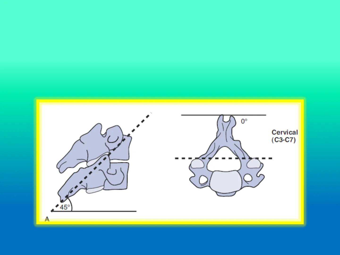# OSTEOLOGíA DE LA
COLUMNA
VERTEBRAL
KLGO. HUGO LOPEZ PERIC. # Posture Analysis
This image shows a posture analysis with numbered points