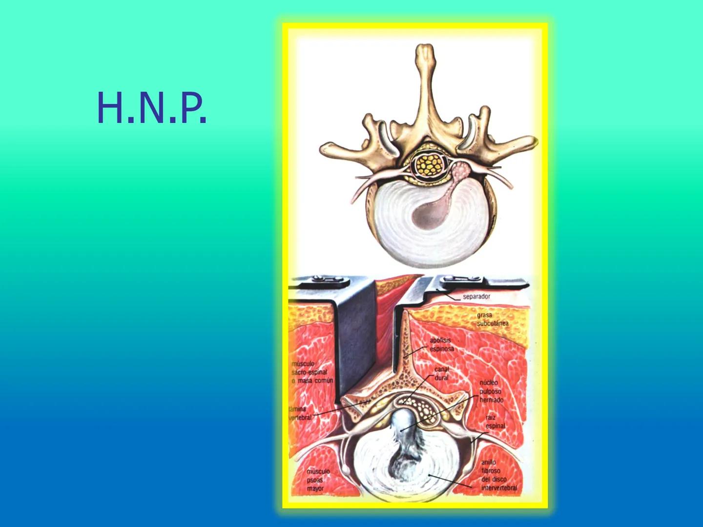 # OSTEOLOGíA DE LA
COLUMNA
VERTEBRAL
KLGO. HUGO LOPEZ PERIC. # Posture Analysis
This image shows a posture analysis with numbered points