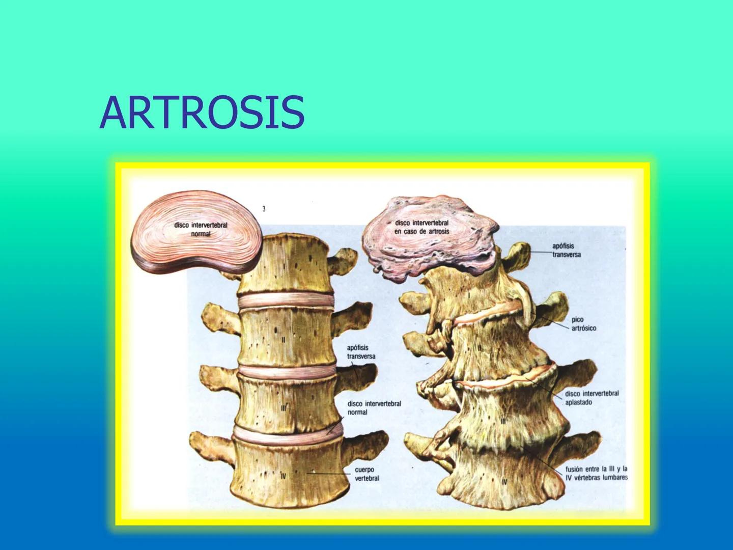# OSTEOLOGíA DE LA
COLUMNA
VERTEBRAL
KLGO. HUGO LOPEZ PERIC. # Posture Analysis
This image shows a posture analysis with numbered points