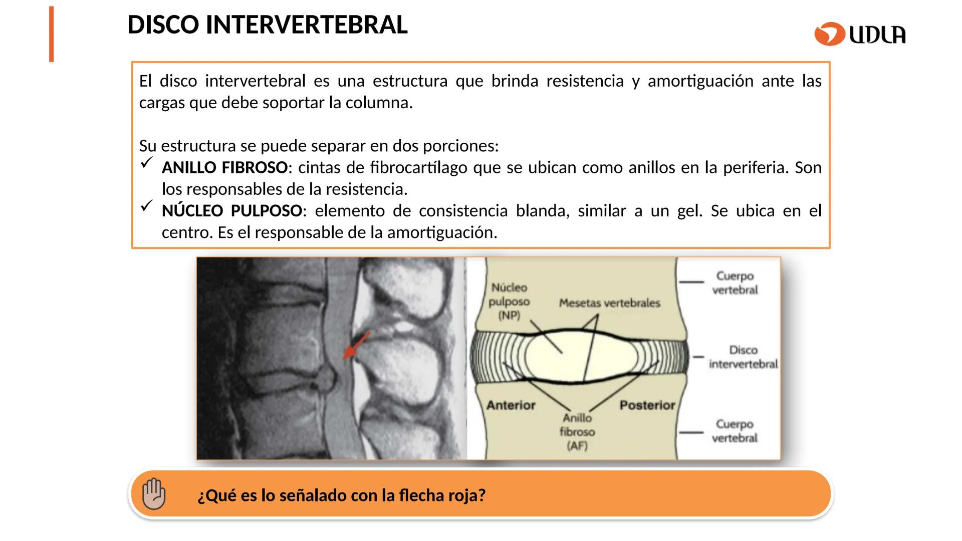 03
01
02
04
UDLA
UNIVERSIDAD DE LAS AMÉRICAS
Cabeza y columna
vertebral
Unidad 2 : Sistema Locomotor.
Asignatura : MYF 101 - Morfología y fu