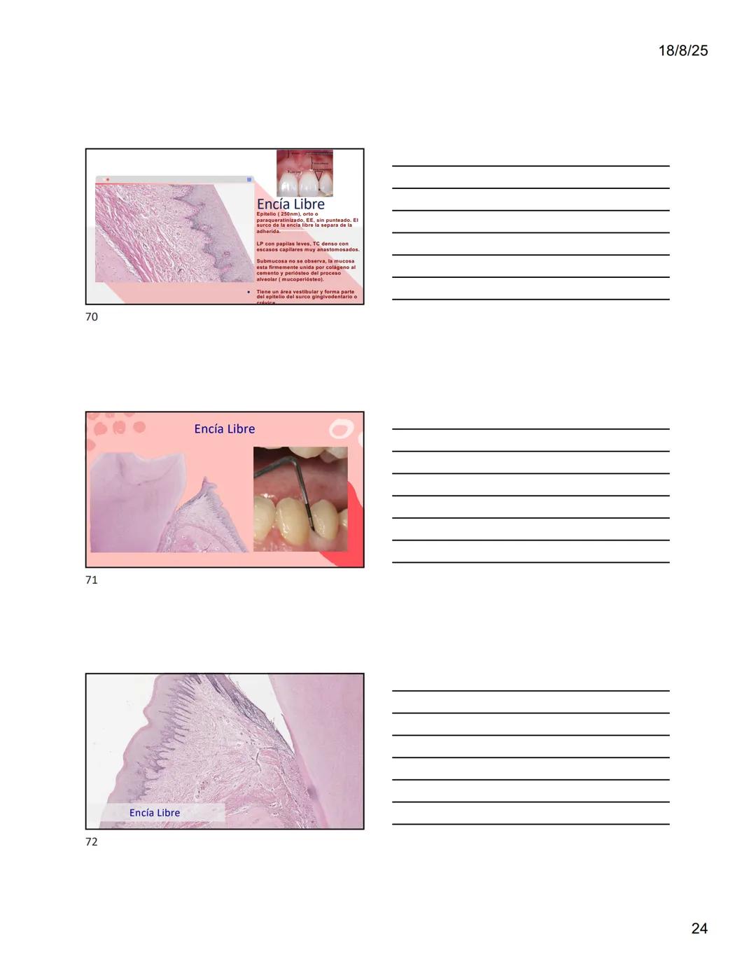 1
Dra. Doris Otero
Histologia Oral
Morfologis Del Sistema
Estomatognático
Mucosa Oral
Contenido
Mucosa -
Generalidades
Mucosa De
Revestimien
