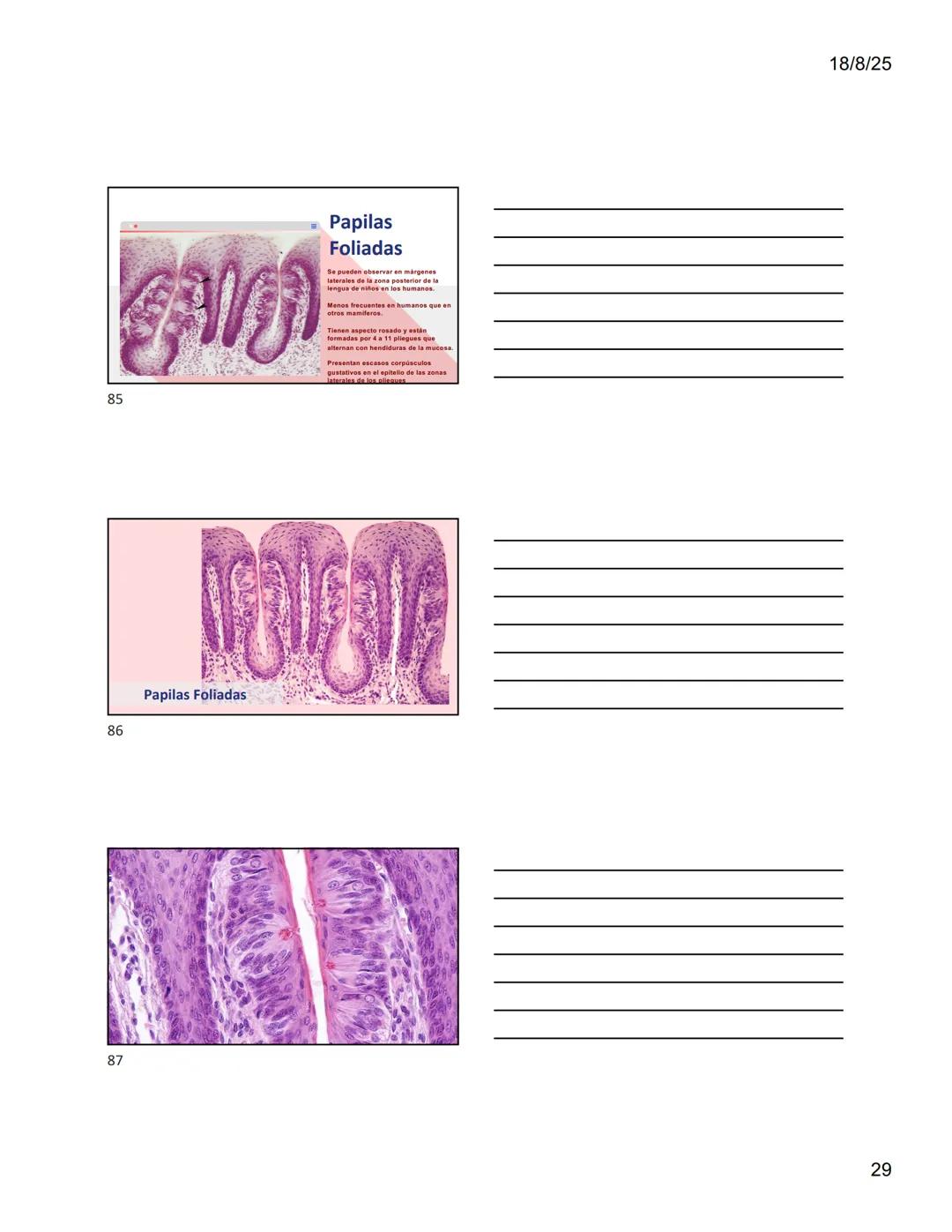 1
Dra. Doris Otero
Histologia Oral
Morfologis Del Sistema
Estomatognático
Mucosa Oral
Contenido
Mucosa -
Generalidades
Mucosa De
Revestimien