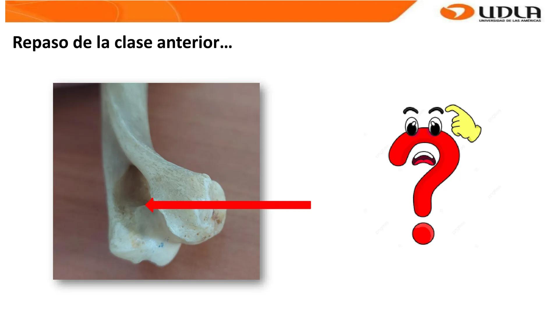 UDLA
UNIVERSIDAD DE LAS AMERICAS
Bienvenidos a
ANATOMÍA del CANINO
CVE292 - 2025
M.V. Mariantú Robles Z.
MEDICINA VETERINARIA
FACULTAD DE ME