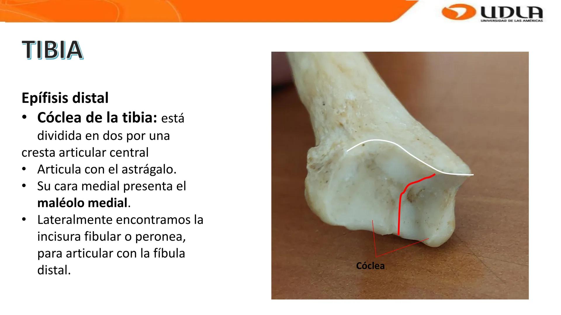 UDLA
UNIVERSIDAD DE LAS AMERICAS
Bienvenidos a
ANATOMÍA del CANINO
CVE292 - 2025
M.V. Mariantú Robles Z.
MEDICINA VETERINARIA
FACULTAD DE ME