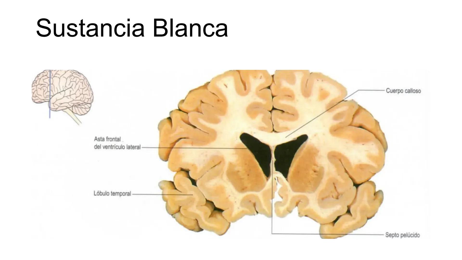 E
Universidad
Central
Facultad de Medicina
y Ciencias de la Salud
Neuroanatomía:
Encéfalo
configuración
interna y externa
Equipo Anatomía