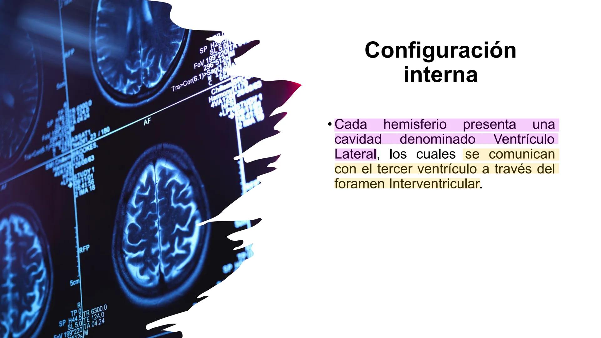 E
Universidad
Central
Facultad de Medicina
y Ciencias de la Salud
Neuroanatomía:
Encéfalo
configuración
interna y externa
Equipo Anatomía