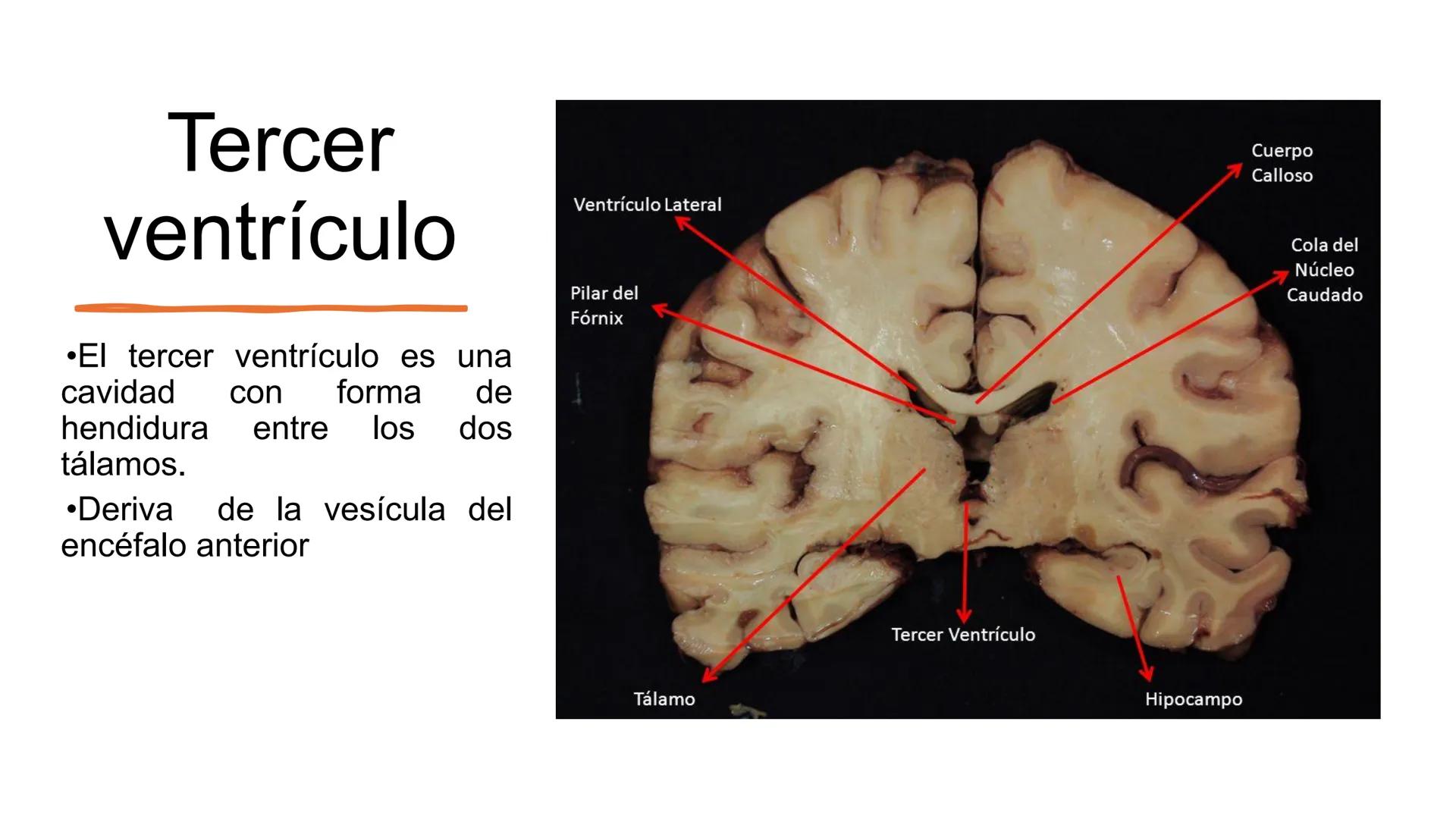 E
Universidad
Central
Facultad de Medicina
y Ciencias de la Salud
Neuroanatomía:
Encéfalo
configuración
interna y externa
Equipo Anatomía