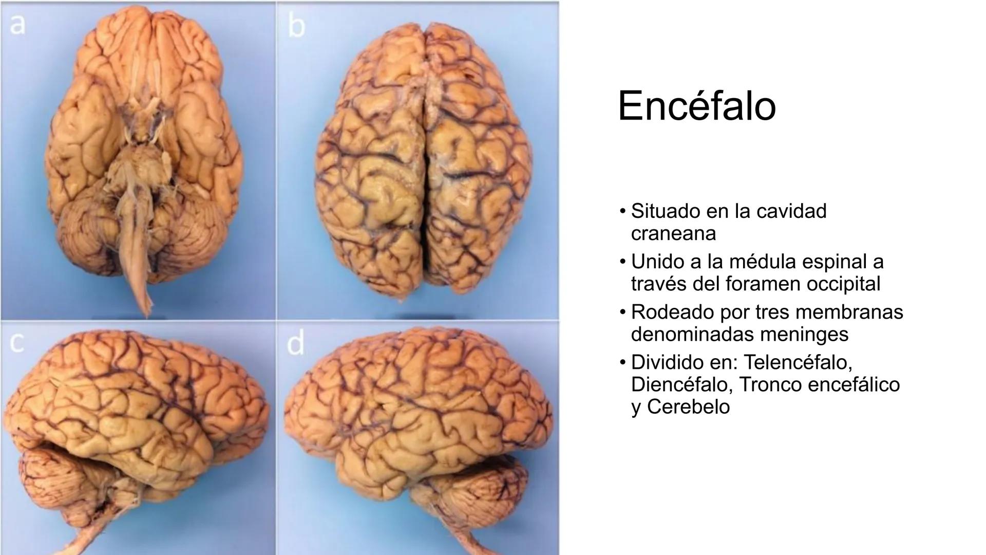 E
Universidad
Central
Facultad de Medicina
y Ciencias de la Salud
Neuroanatomía:
Encéfalo
configuración
interna y externa
Equipo Anatomía
