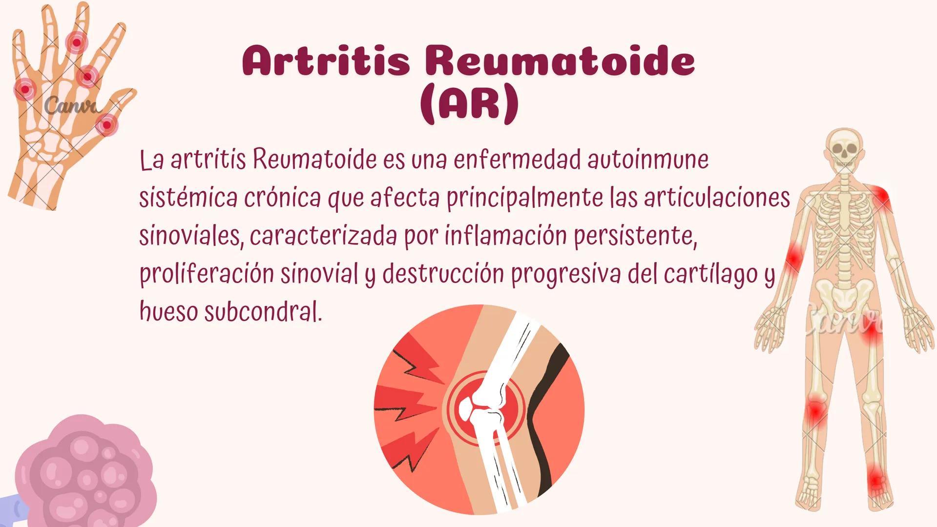 # Fisiopatologia de
enfermidades
autoimunes
Constanza Maureira # Introducción
Las enfermedades autoinmunes constituyen un grupo de trastor