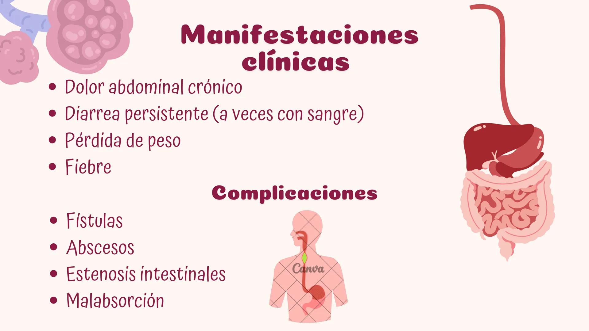# Fisiopatologia de
enfermidades
autoimunes
Constanza Maureira # Introducción
Las enfermedades autoinmunes constituyen un grupo de trastor
