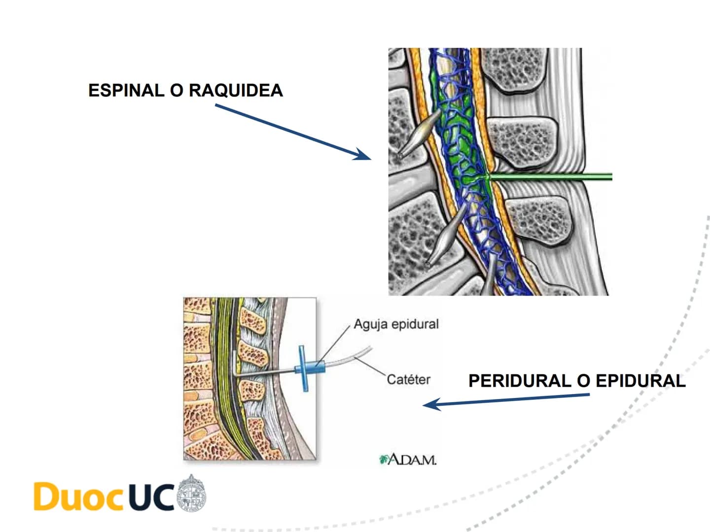 # CUIDADOS DE ENFERMERIA EN EL
# PROCESO PERIOPERATORIO
# DuocUC ¿Recuerdo o no la clase anterior? # Resultados de aprendizaje
• Conocer