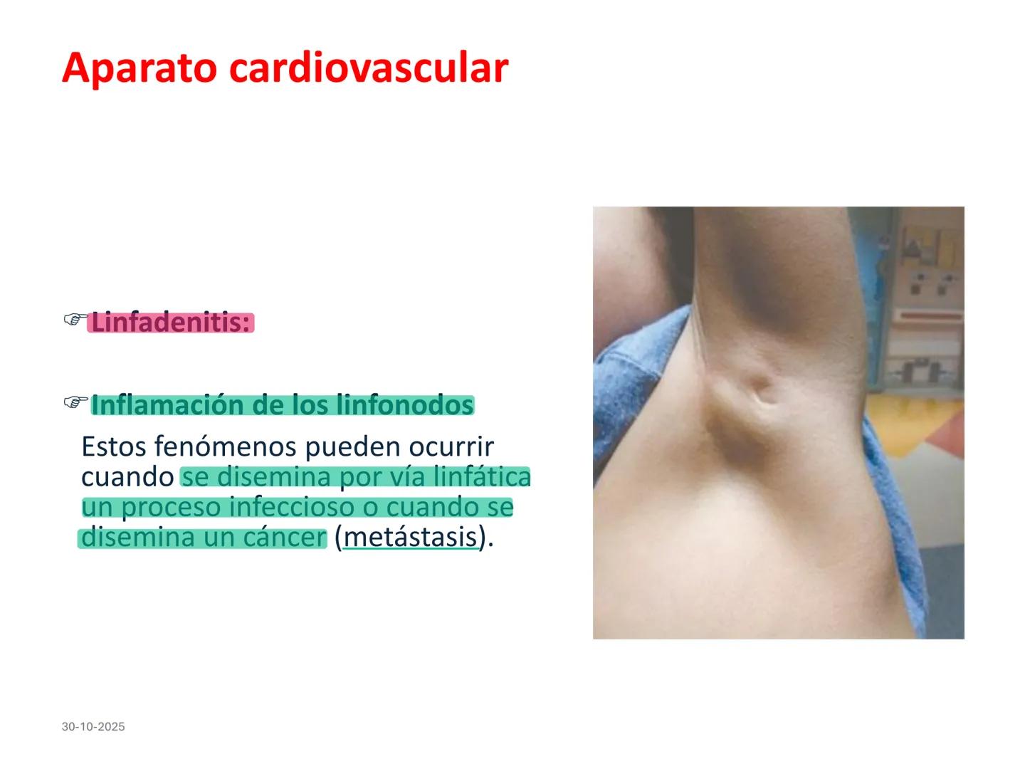 # Aparato cardiovascular
## El sistema linfático:
Es una vasta red de vasos
linfáticos, comunicados por
linfonodos.
Conducto
linfático
de
