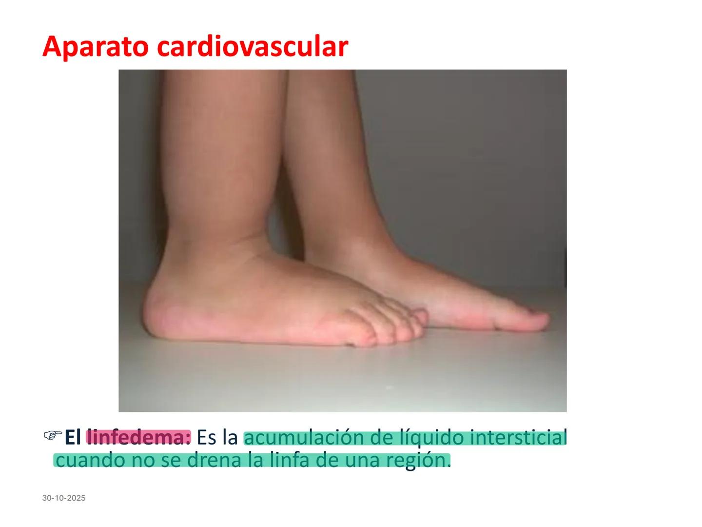 # Aparato cardiovascular
## El sistema linfático:
Es una vasta red de vasos
linfáticos, comunicados por
linfonodos.
Conducto
linfático
de