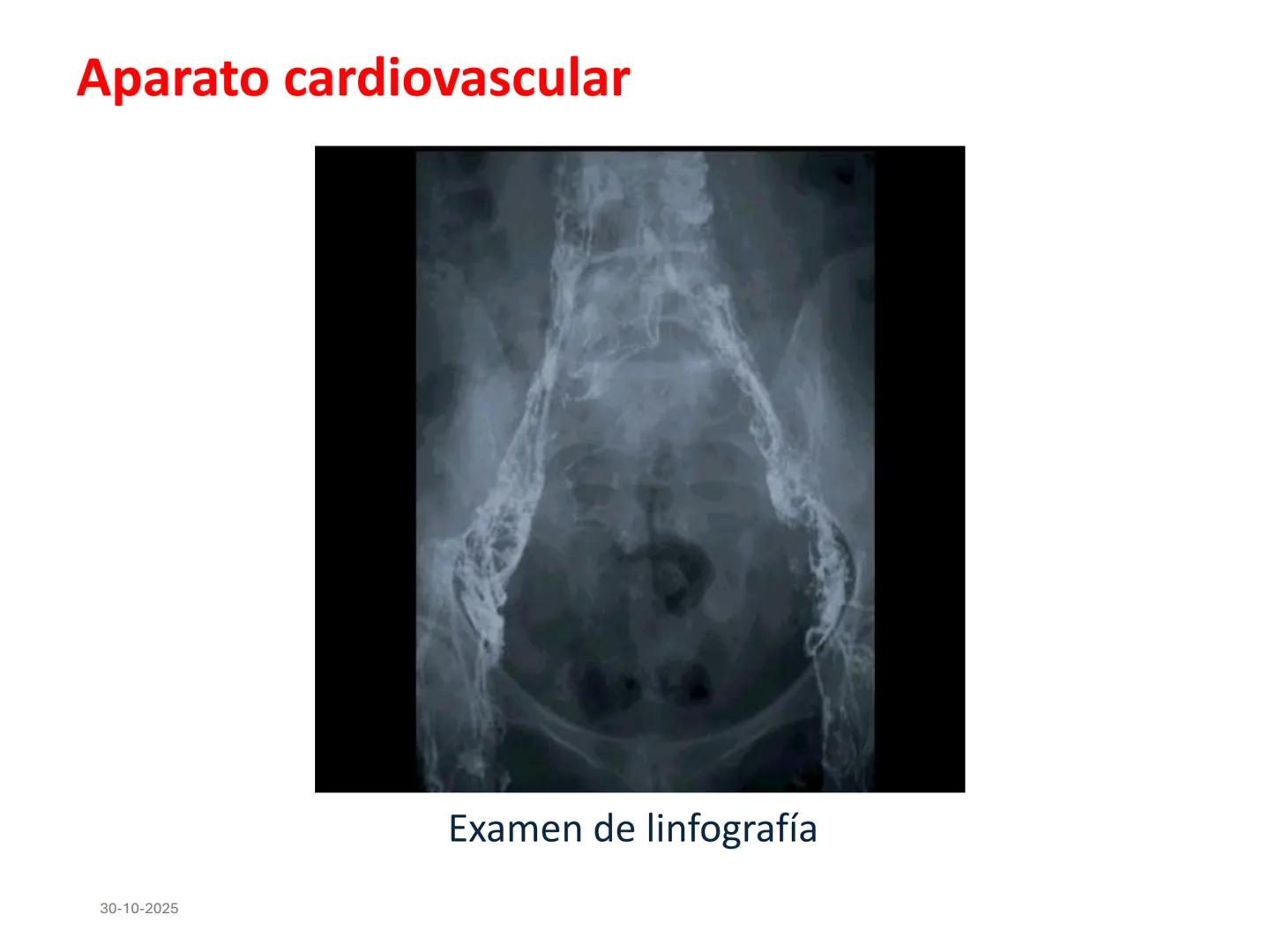 # Aparato cardiovascular
## El sistema linfático:
Es una vasta red de vasos
linfáticos, comunicados por
linfonodos.
Conducto
linfático
de