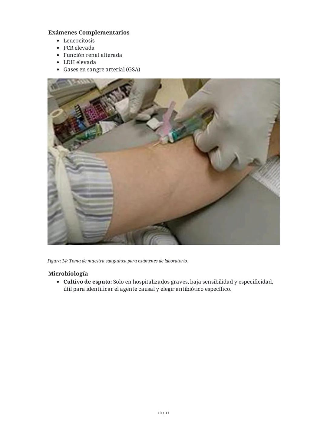 Neumonía Adquirida en la Comunidad (NAC) e Insuficiencia
Respiratoria
1. Introducción al Sistema Respiratorio y Neumonía
La neumonía adquiri
