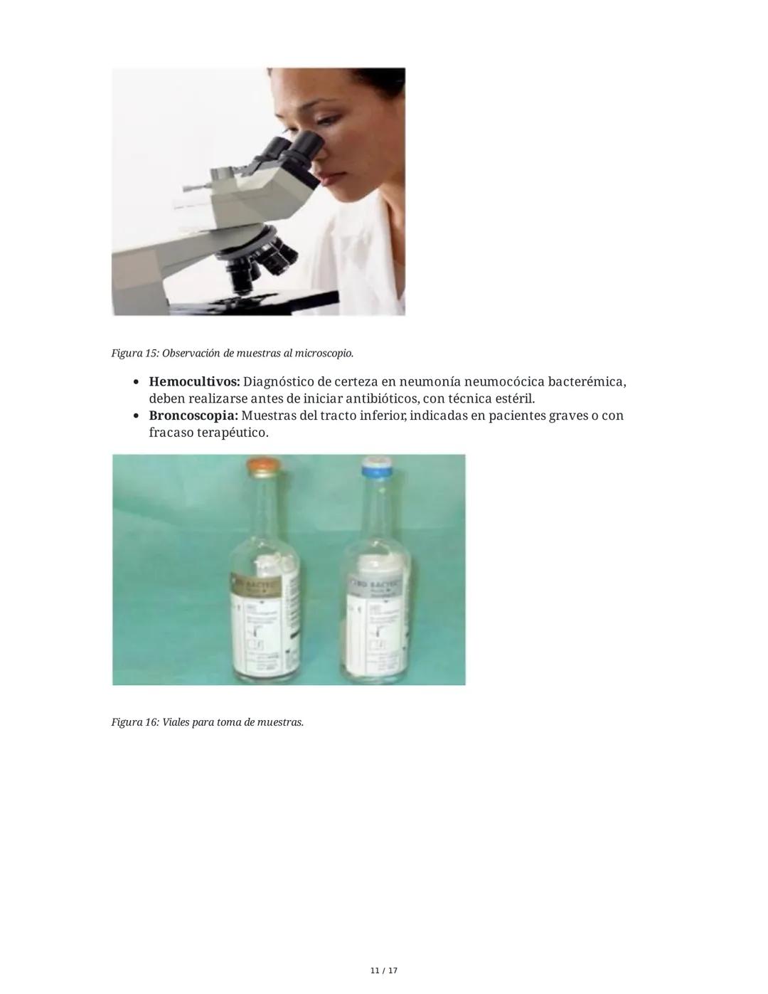 Neumonía Adquirida en la Comunidad (NAC) e Insuficiencia
Respiratoria
1. Introducción al Sistema Respiratorio y Neumonía
La neumonía adquiri