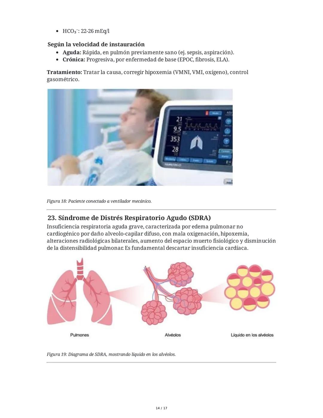 Neumonía Adquirida en la Comunidad (NAC) e Insuficiencia
Respiratoria
1. Introducción al Sistema Respiratorio y Neumonía
La neumonía adquiri