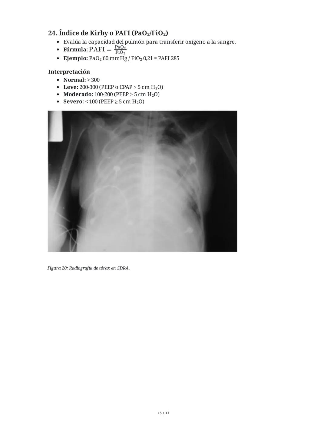 Neumonía Adquirida en la Comunidad (NAC) e Insuficiencia
Respiratoria
1. Introducción al Sistema Respiratorio y Neumonía
La neumonía adquiri
