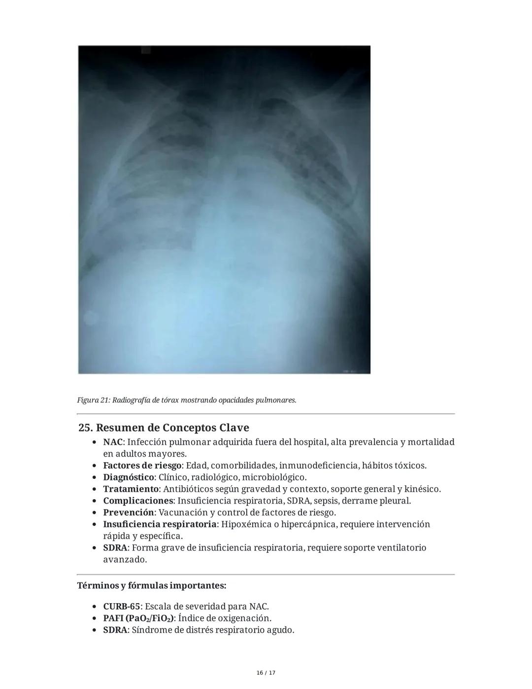 Neumonía Adquirida en la Comunidad (NAC) e Insuficiencia
Respiratoria
1. Introducción al Sistema Respiratorio y Neumonía
La neumonía adquiri