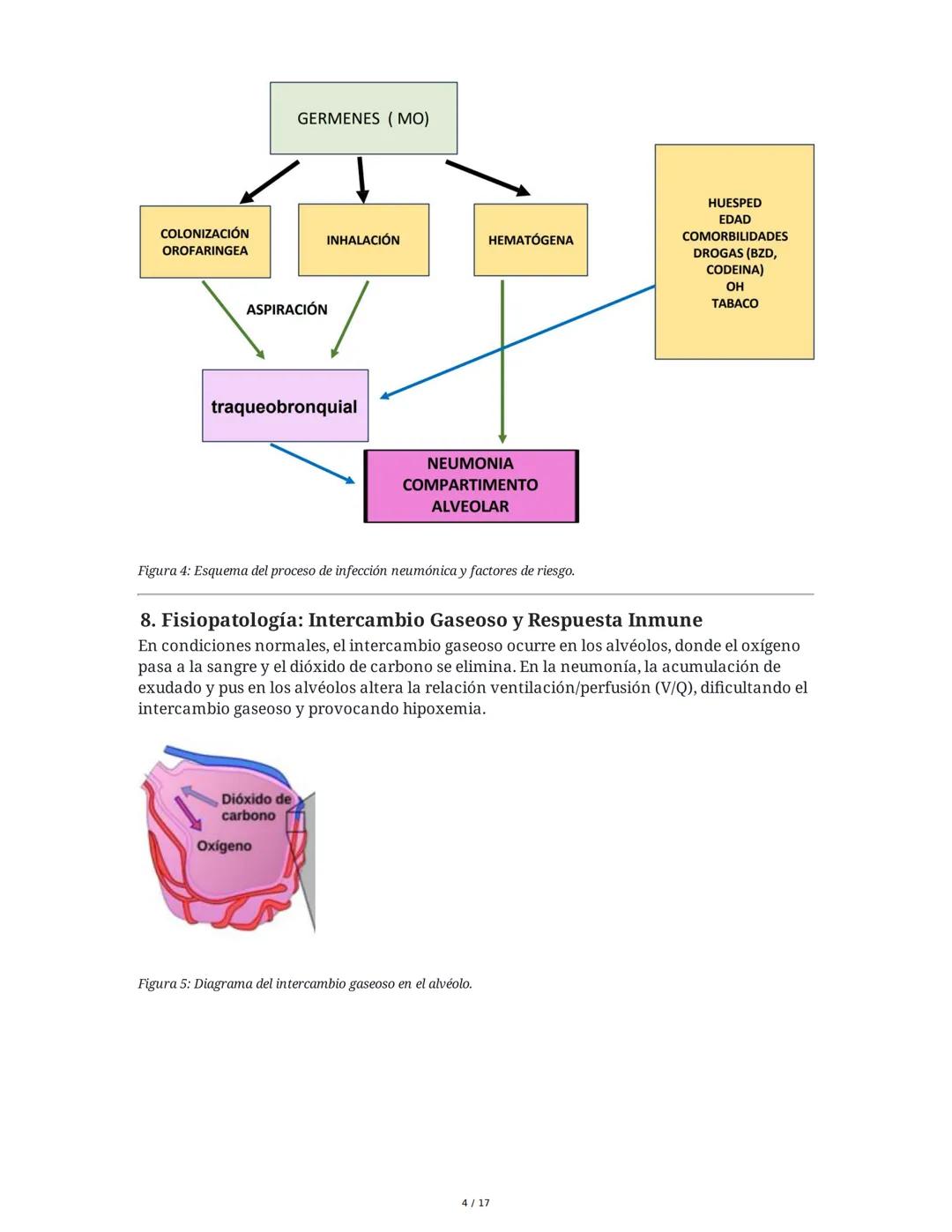 Neumonía Adquirida en la Comunidad (NAC) e Insuficiencia
Respiratoria
1. Introducción al Sistema Respiratorio y Neumonía
La neumonía adquiri